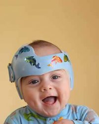 what is craniosynostosis surgery