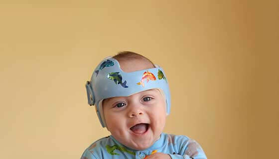 what is craniosynostosis surgery