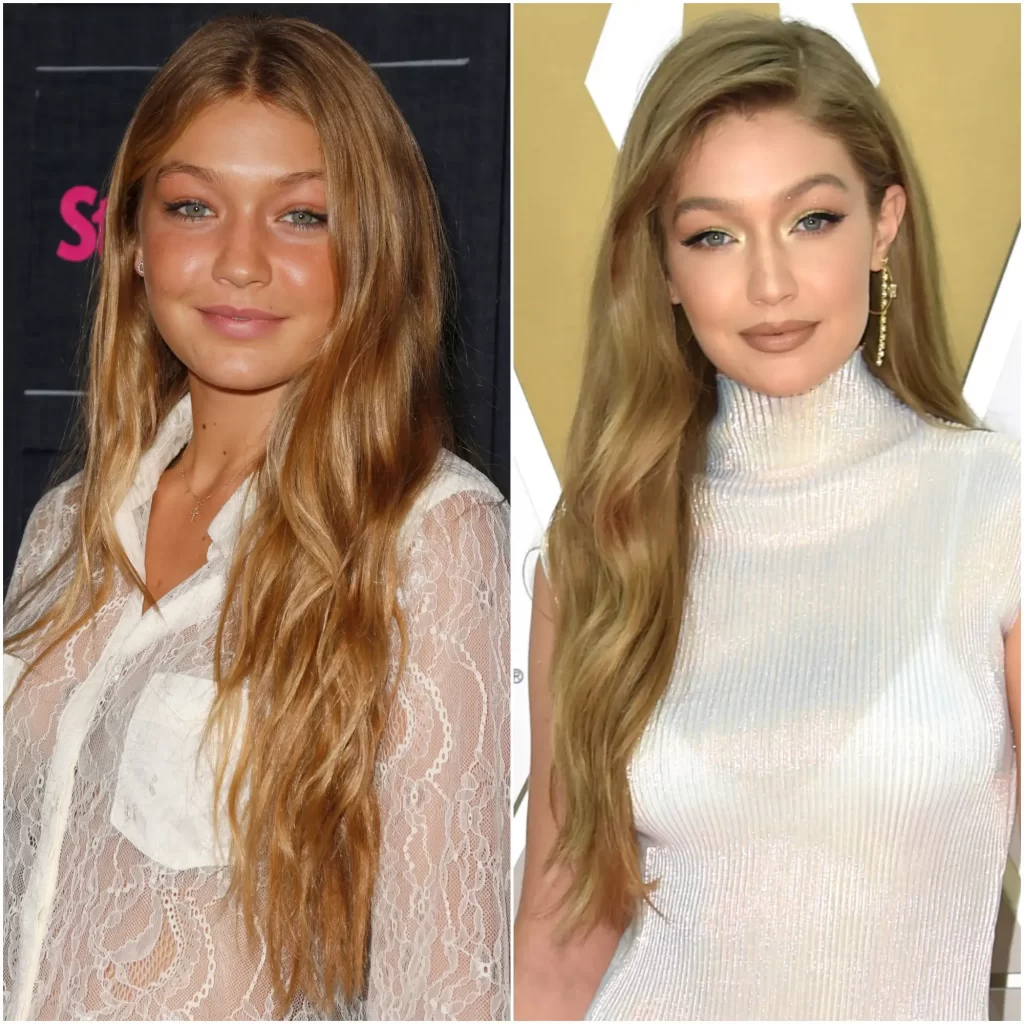 Les chirurgies plastiques de Gigi Hadid