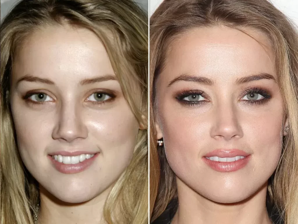 amber-heard-plastische-chirurgie Amber Heard Plastische Chirurgie
