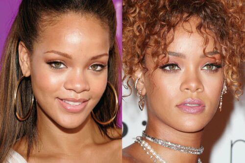 Chirurgie Plastique de Rihanna