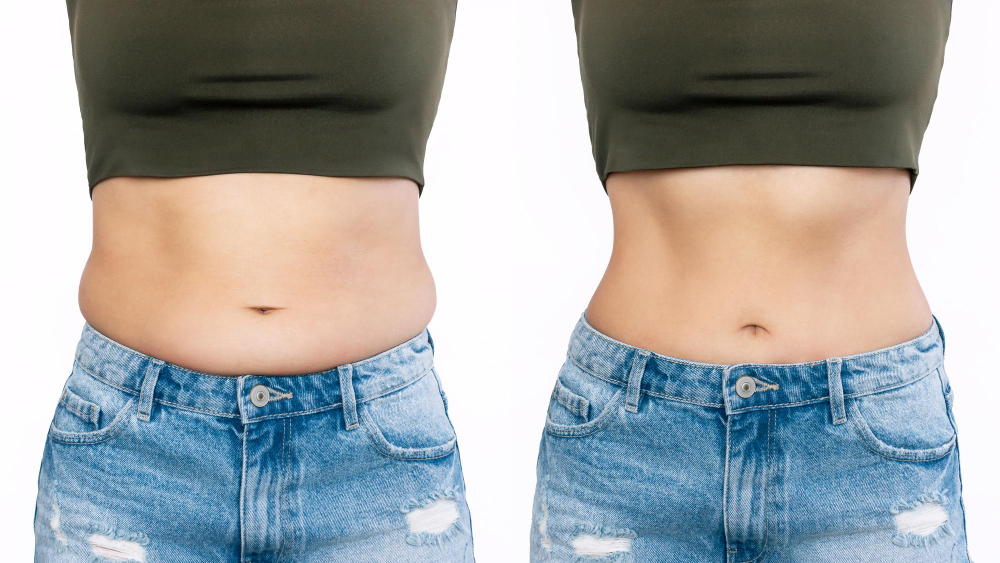 two-shots-woman-s-belly-with-excess-fat-toned-stomach-before-after-losing-weight
