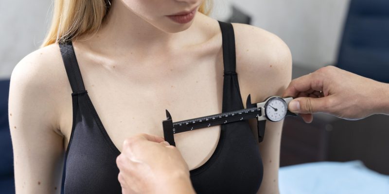 breast-implant-milano-clinic-turkey02-scaled.jpg breast-implant-milano-clinic-turkey02-scaled.jpg